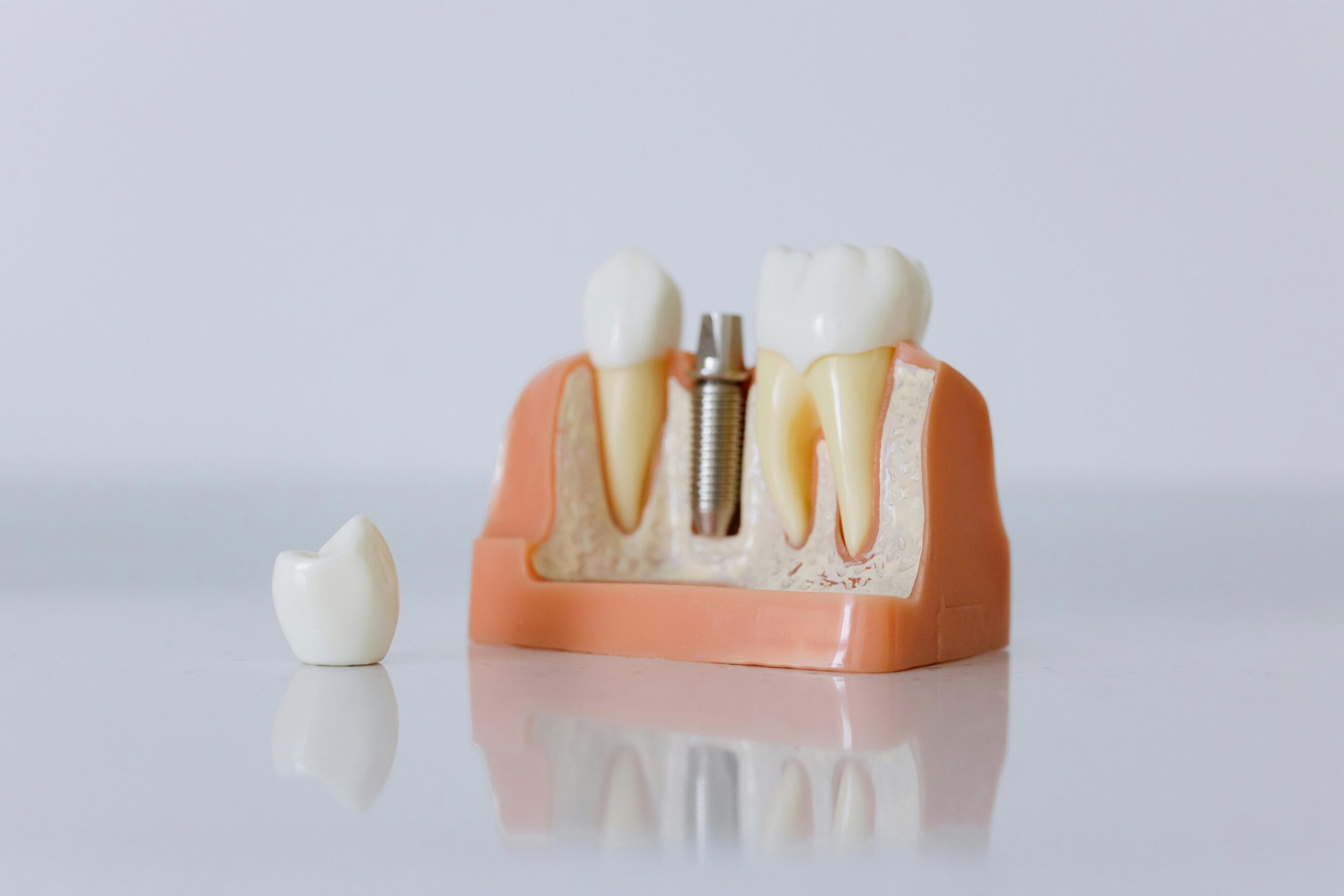 implant